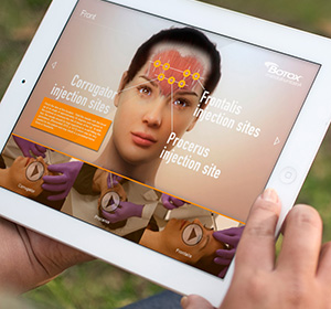 Allergan — Botox