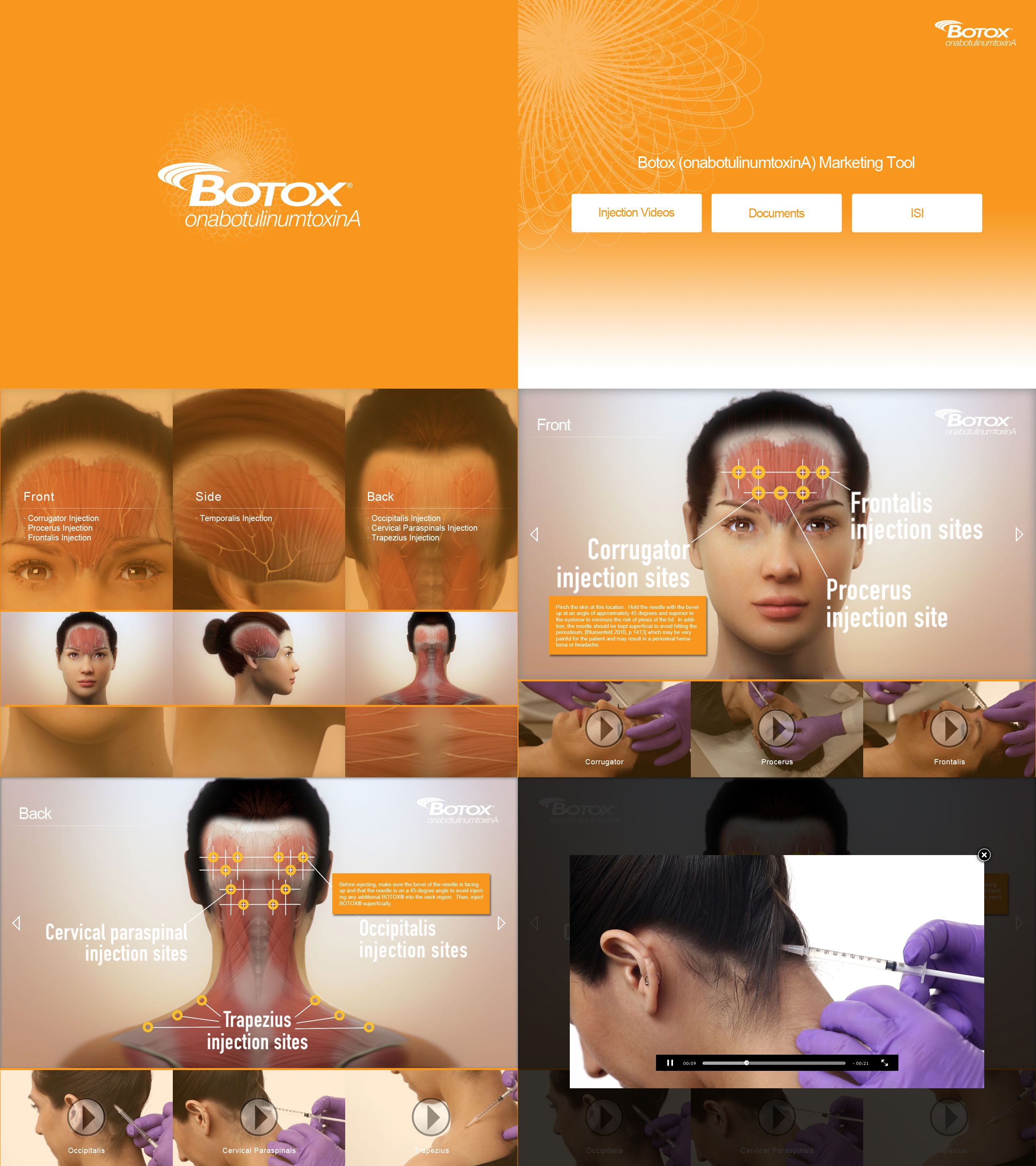 Interface screens overview